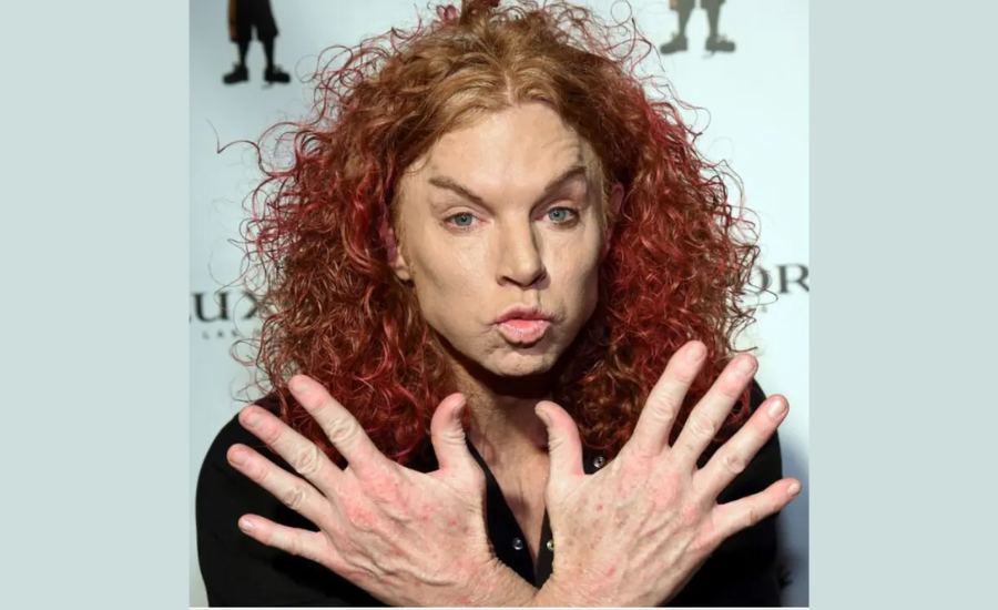 Facts About Carrot Top 